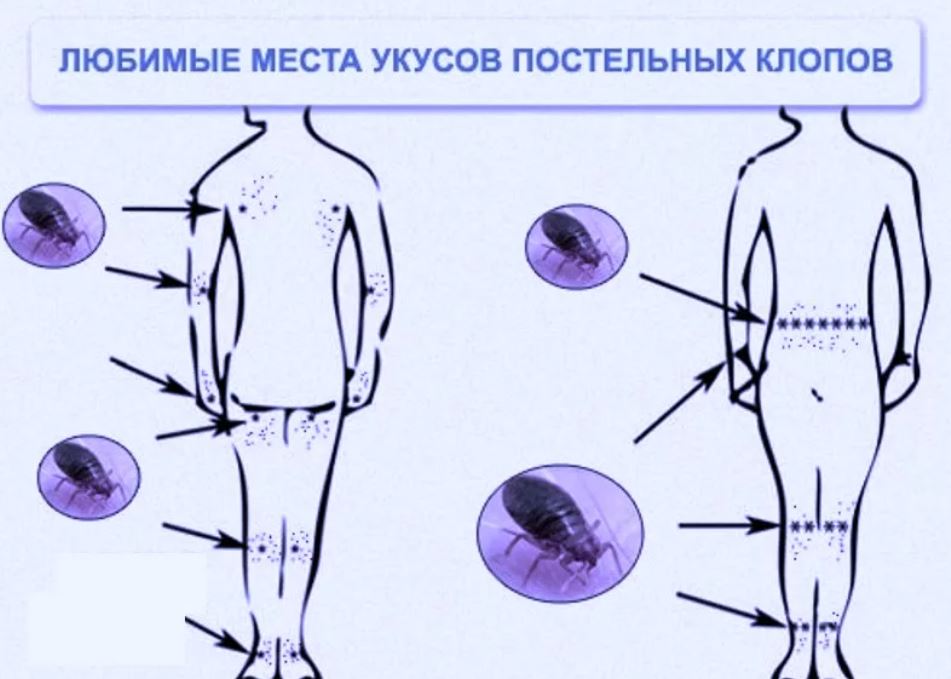 Сон Засос на щеке. Толкование сна Засос на щеке бесплатно онлайн